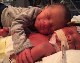 Parents Brandy Guettler and Tommy Buchmeyer of twin boys Mason and Hawk Buchmeyer
Three-week-old Hawk Buchmeyer, who was pictured being comforted by his brother, passed away after developing a rare condition